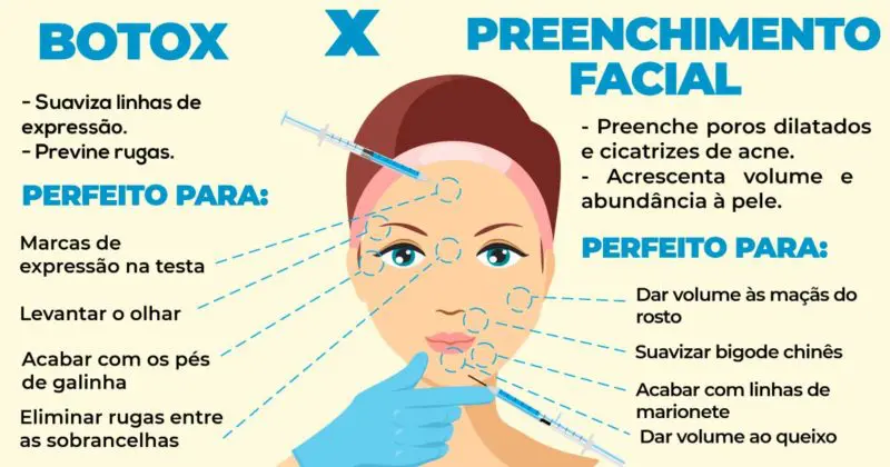 Principais diferenças entre botox e preenchimento facial